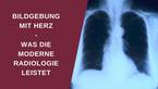 Bildgebung mit Herz